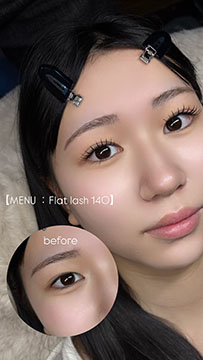 BMJ eyelash